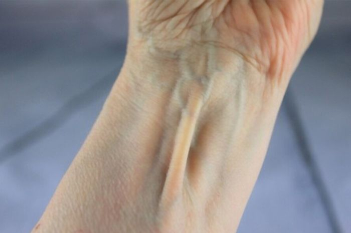 10 Bagian yang dianggap Tidak Berguna Pada Tubuh Manusia